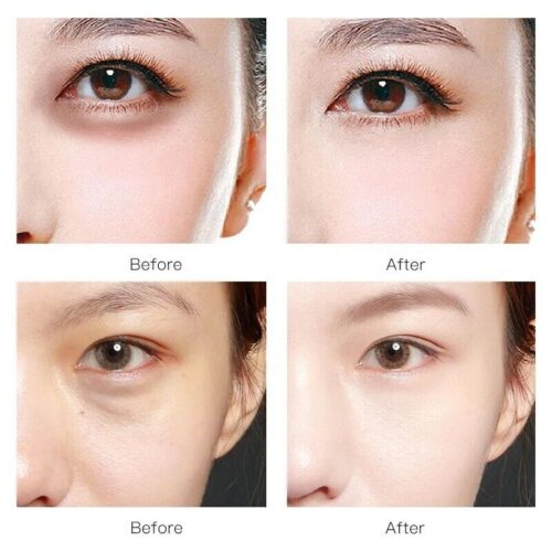 Augen Pads Gold Kollagen, Für Falten, Feine Linien, Augenringe Anti Aging 60 Pcs - Image 6