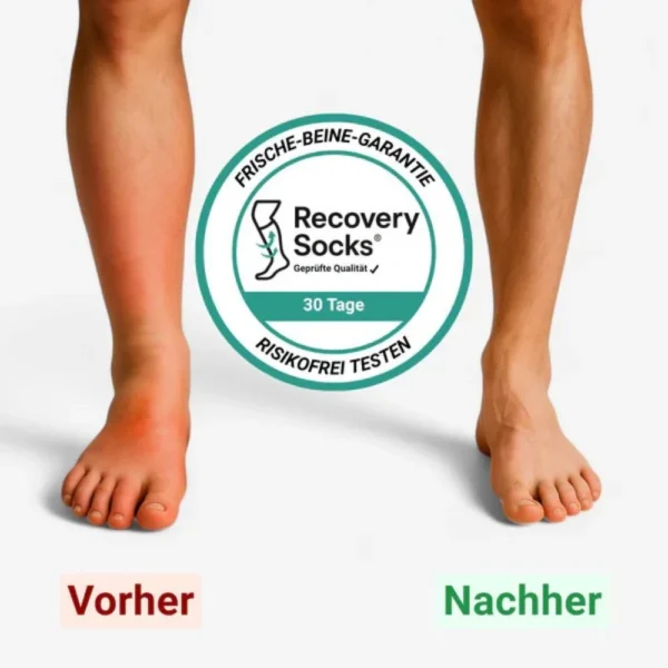 Compression Socks
