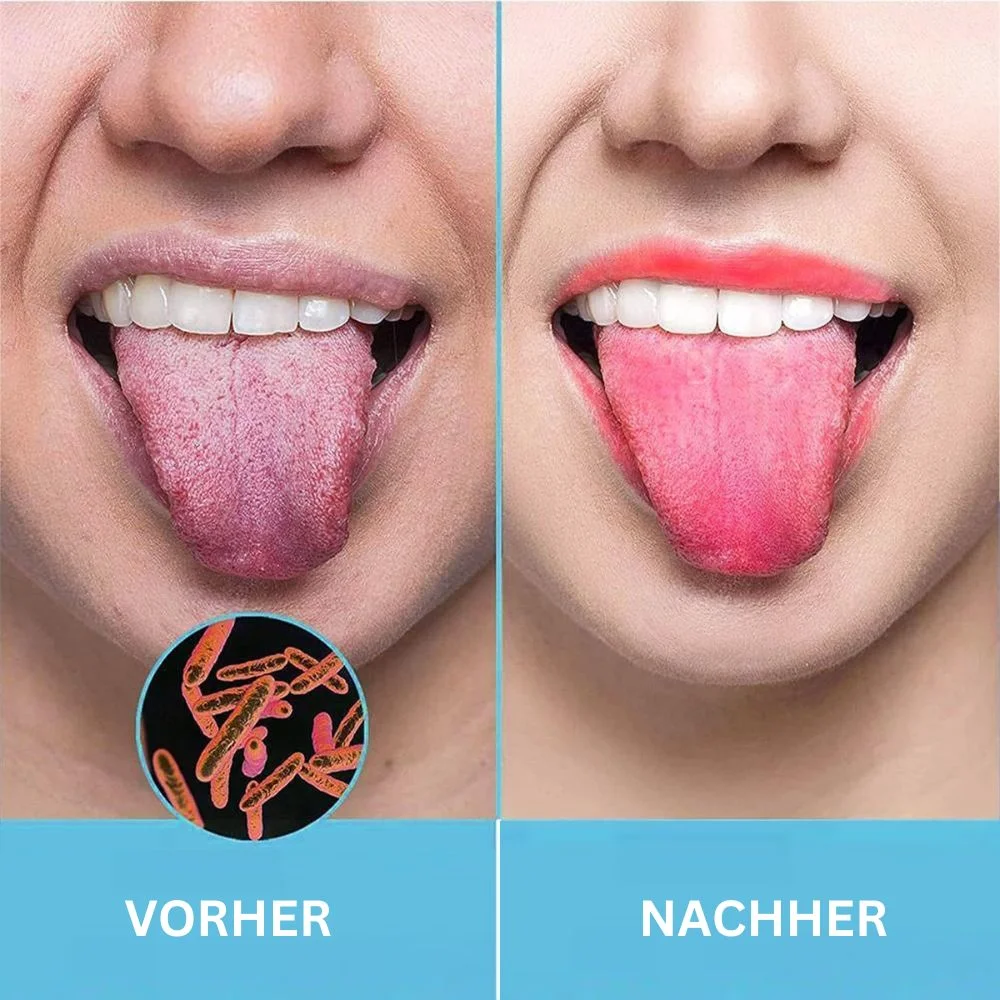 Zungenschaber aus Edelstahl, 2er-Set